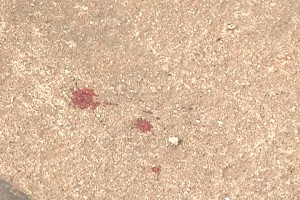Sangre de la victima